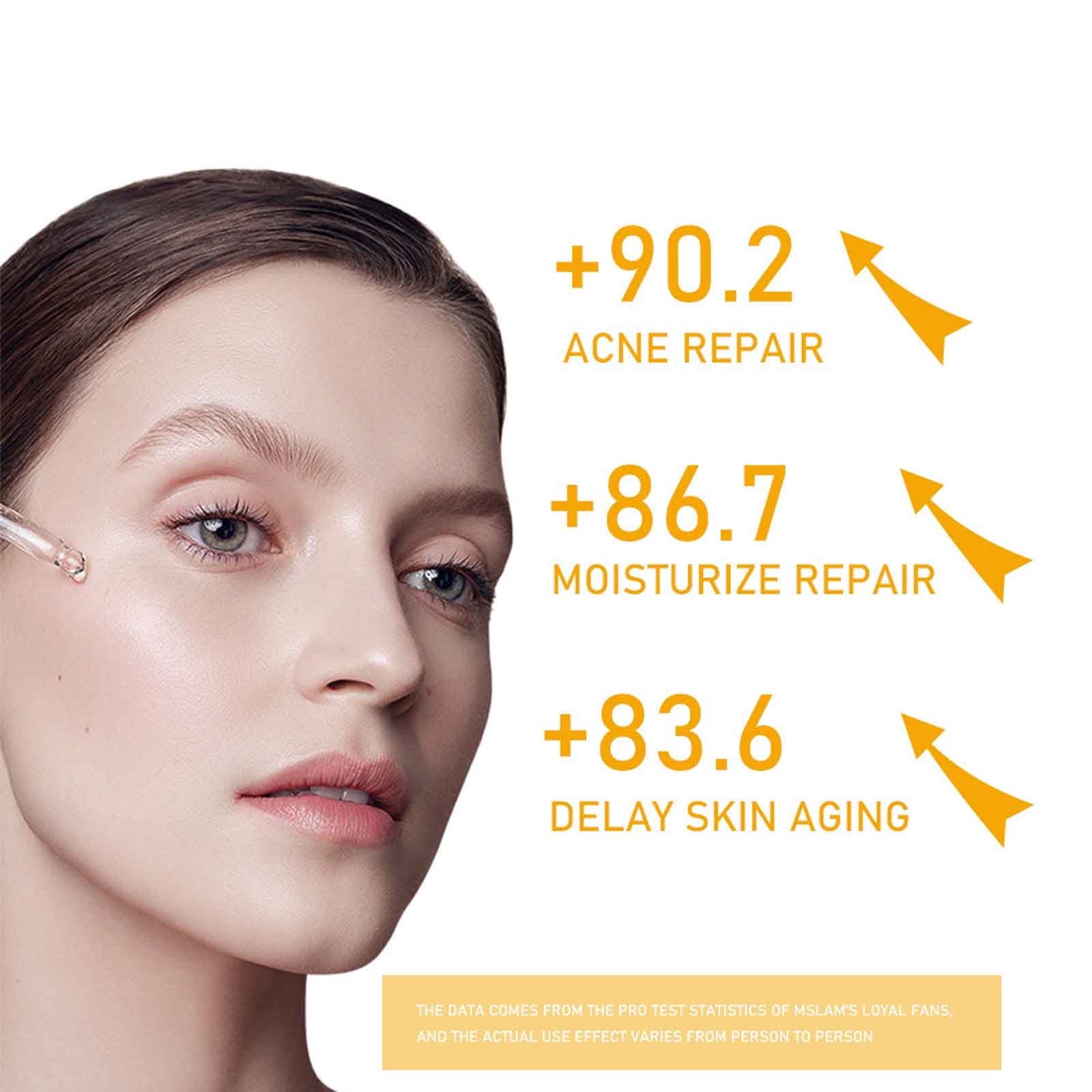 Turmeric Serum For Dark Spots Turmeric Dark Spots Corrector Serum For Face Moisturizing Massage Essence Reduces Hyper Pigmentation Age&amp;Sun Spots 30ml,Essence Clearance,White
