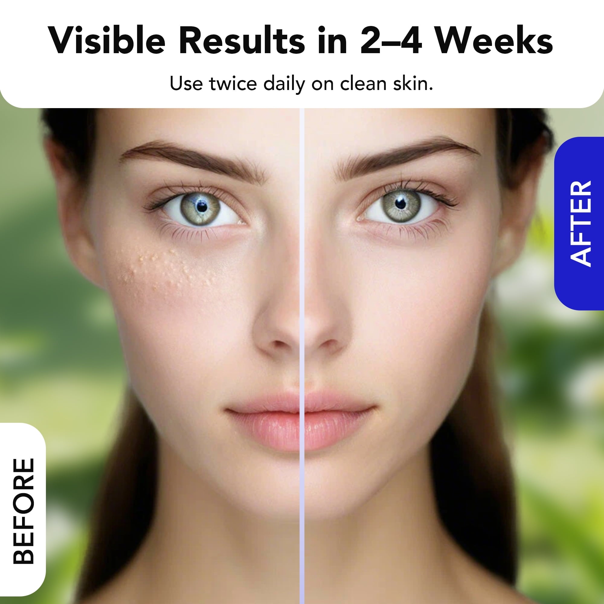 30 mL Treatment, Milia Spot Treatment with Salicylic Acid Milia Acne Serum Clearing Skin Essence