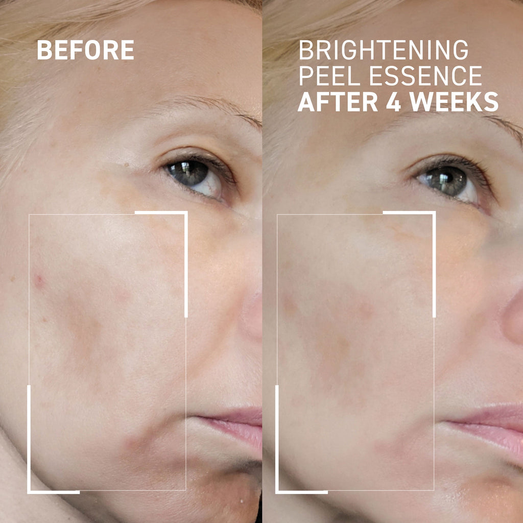 Dr. Brandt Dr. B Lab. Brightening Peel Essence 100 ml