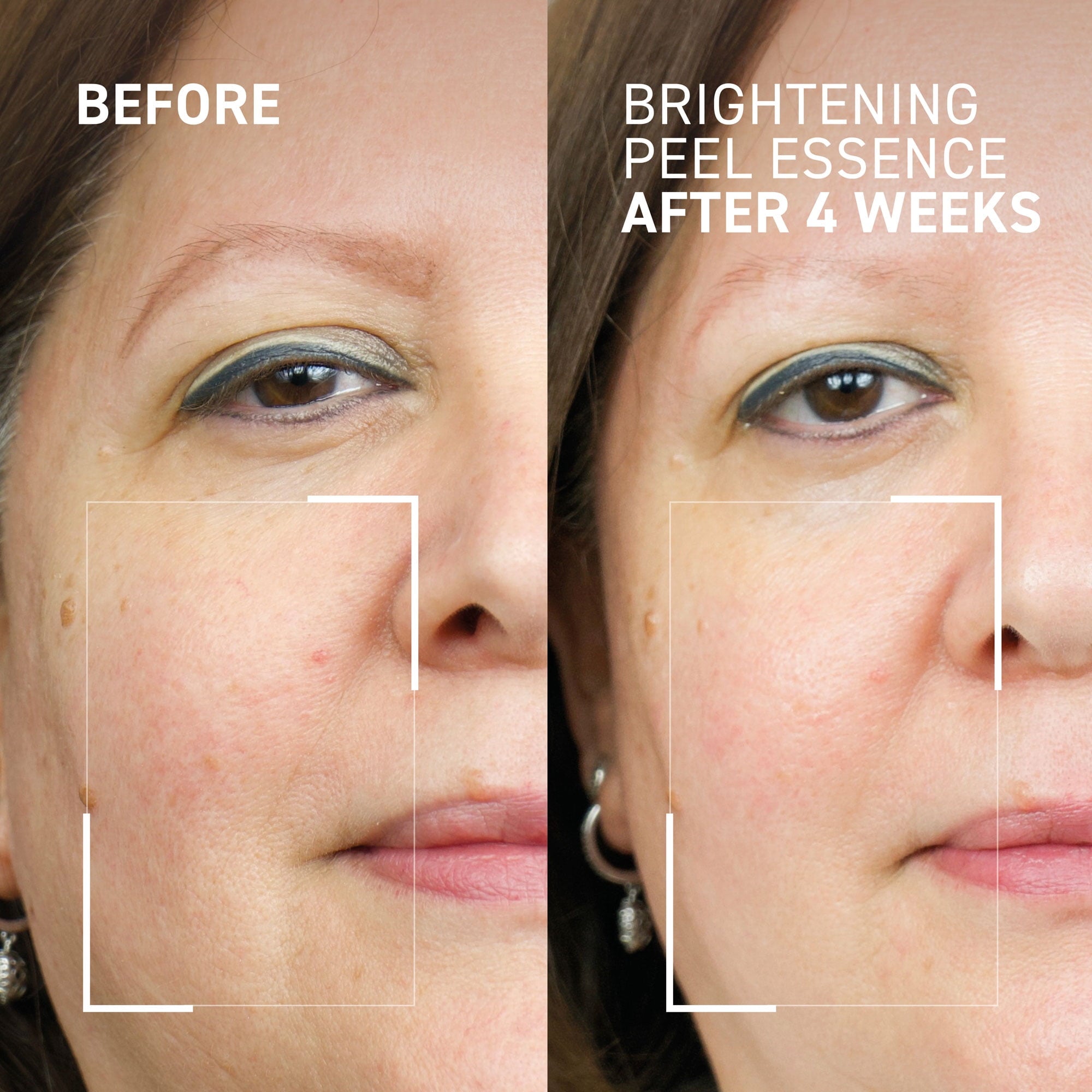 Dr. Brandt Dr. B Lab. Brightening Peel Essence 100 ml