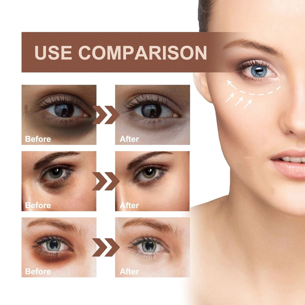 Firming Serum,Aging Eye Serums For Women &amp; Men - Reduces Puffiness, Dark Circles, Under Eye Bags, Wrinkles And Fine Lines Around The Eyes20ML Essence Personal Care Clearance A