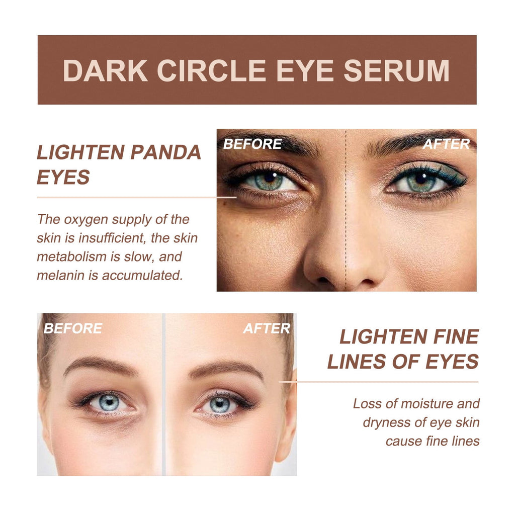 Firming Serum,Aging Eye Serums For Women &amp; Men - Reduces Puffiness, Dark Circles, Under Eye Bags, Wrinkles And Fine Lines Around The Eyes20ML Essence Personal Care Clearance A