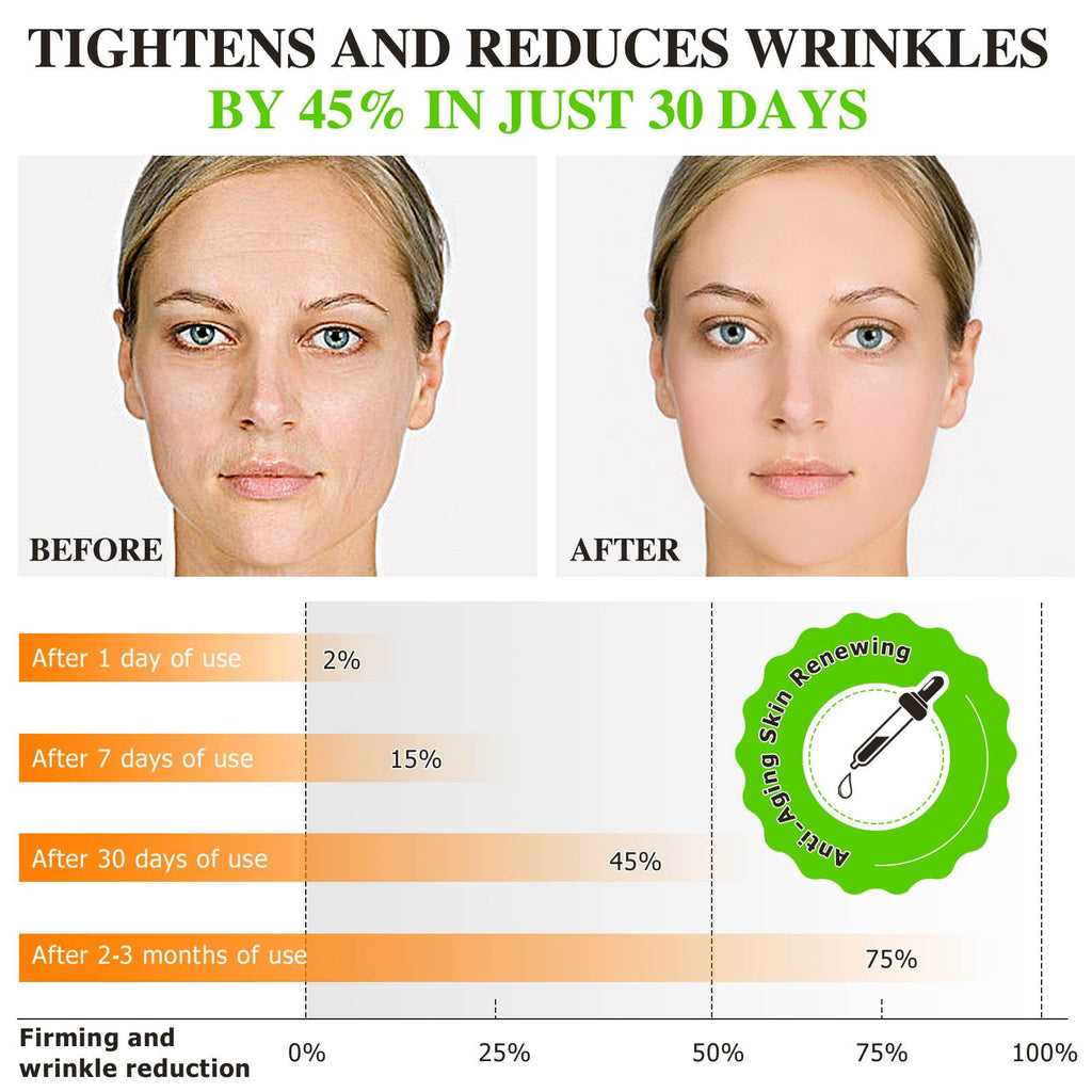 2Pack 20% Vitamin C Serum, Anti Aging Face Essence with Vitamin E, Ferulic Acid, Collagen, Firm Skin - Hydration - Antioxidant - Even Tone