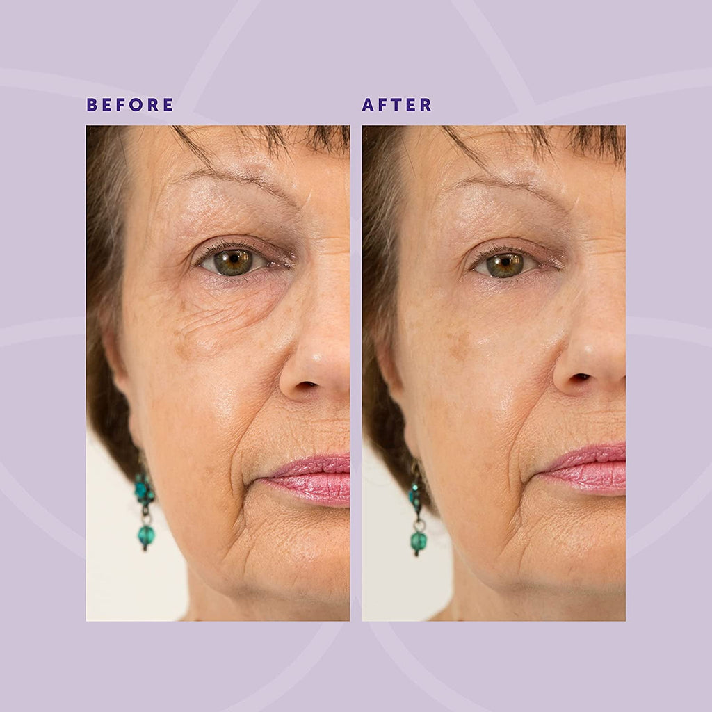 for - 5 Seconds Instant Effect, Anti Aging Fade Wrinkle Fast Absorption Expertise Wrinkle Remover Cream Face Essence Cream, 1oz