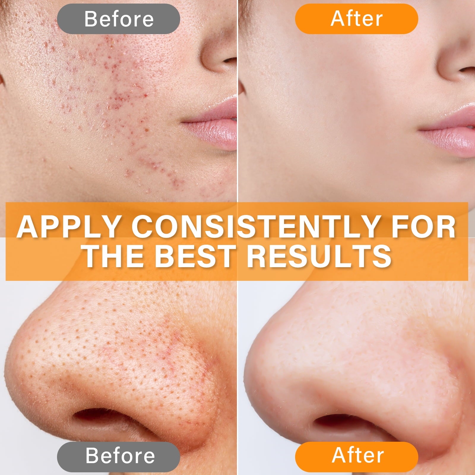 30ml essence of ferulic acid, rich in vitamins and hyaluronic acid. Help improve skin quality, moisturize and nourish.